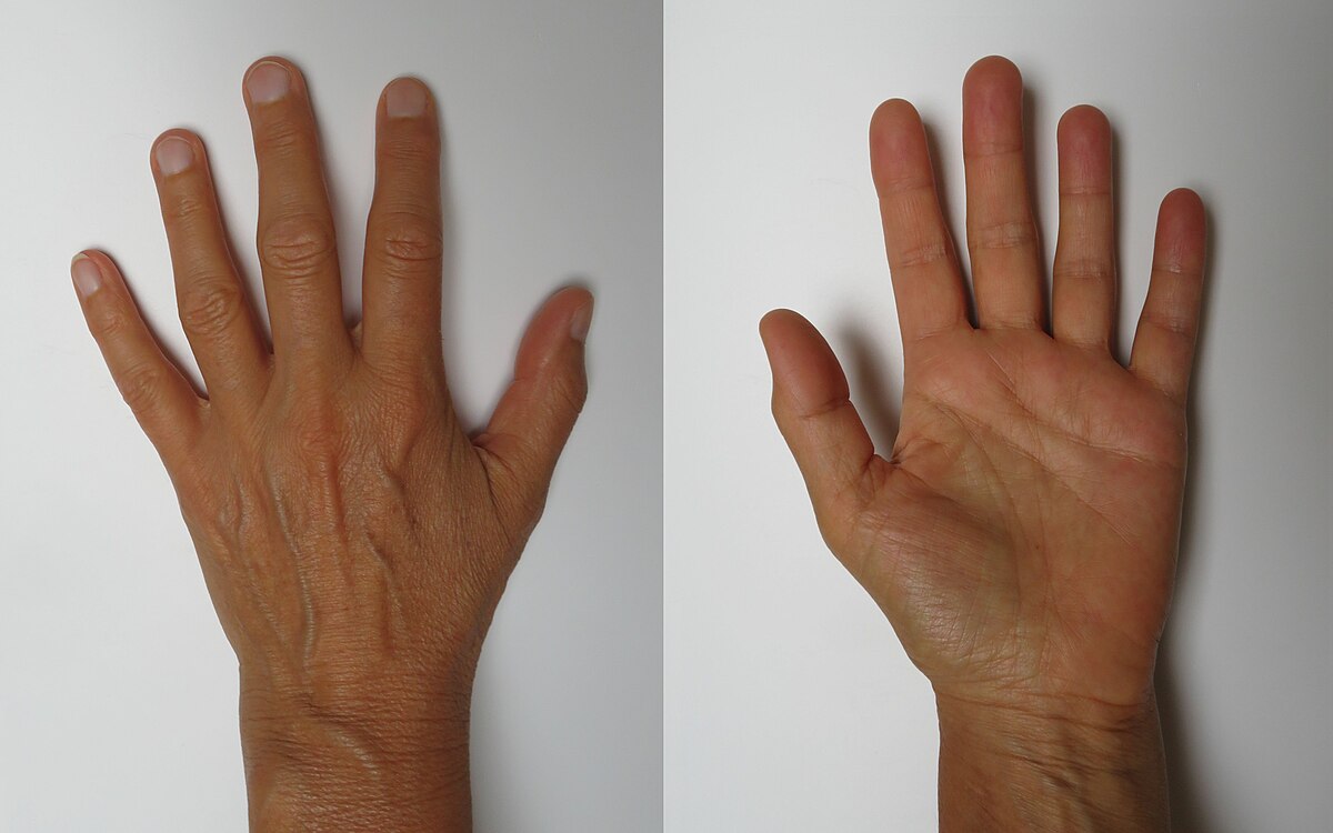 Resultados en las manos